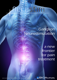Ganglion Neurostimulation