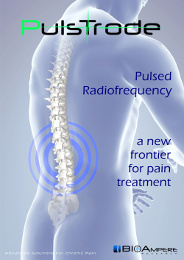 Pulsed Radiofrequency with Pulstrode