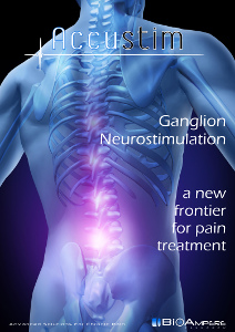 Ganglion Neurostimulation, Accustim-E, brochure, Spinal Radiculopathies, Chronic Low back Pain, Neuropathic Pain