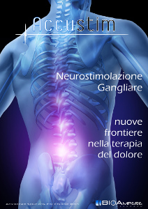 Neurostimolazione Gangliare, Accustim-E, brochure, radicolopatie spinali, dolore neuropatico