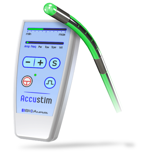 Ganglion Neurostimulation, Accustim-E, electro-catheter, E-Cath