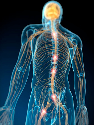 Ganglion Neurostimulation, Accustim-E, electro-catheter, E-Cath, Spinal Radiculopathies