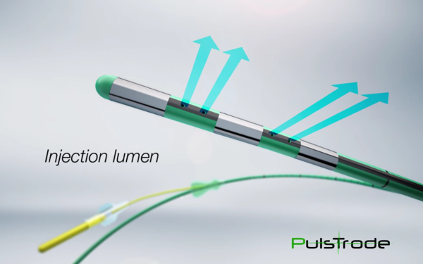 Pulstrode Plus, Bipolar Pulsed Radiofrequency